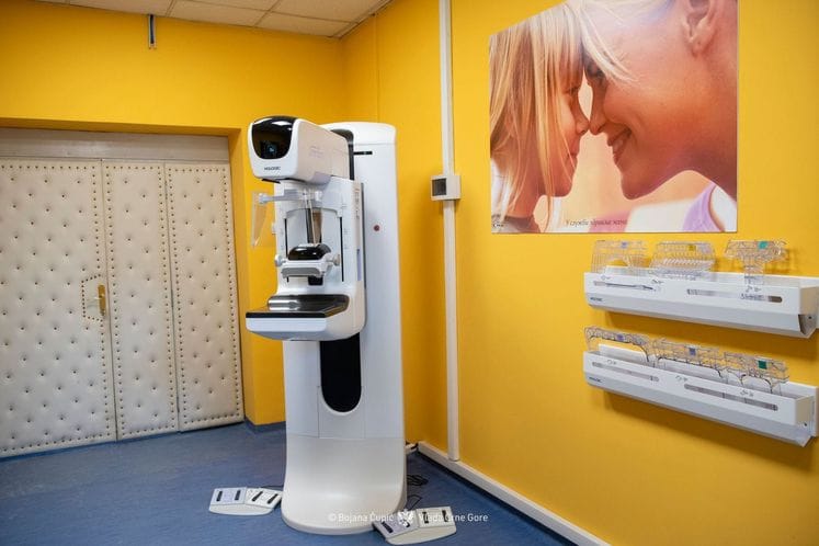 Značajan iskorak u unapređenju zdravstvene zaštite žena u Crnoj Gori